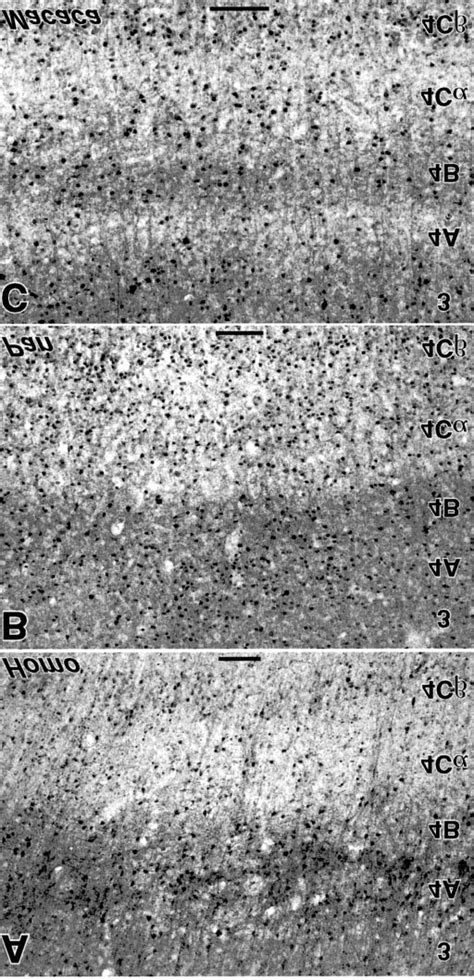 Calbindin immunoreactivity in layer 4 of humans (Homo), chimpanzees ...