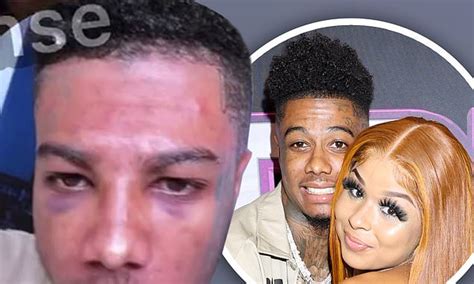 Blueface has two black eyes as he and girlfriend Chrisean Rock flaunt volatile relationship ...