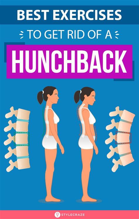 Best Exercises To Get Rid Of A Hunchback | Exercise, Posture exercises, Body posture