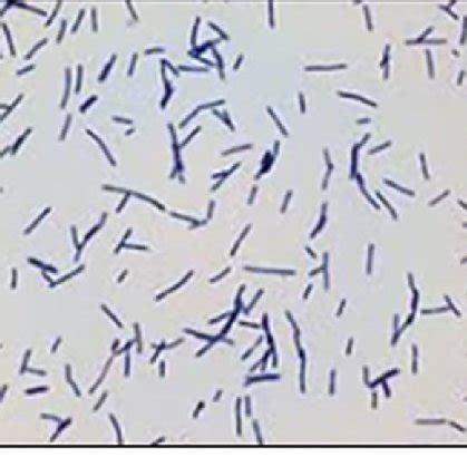 Microscopic view of showed gram positive rod shaped Lactobacillus. | Download Scientific Diagram