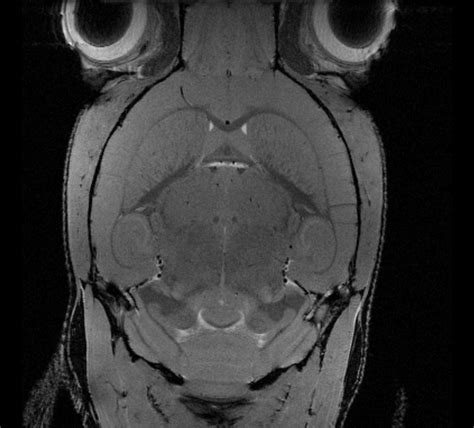 Mouse MRI CryoProbe | Bruker