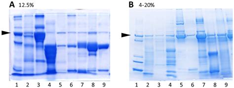 Diagnostics | Free Full-Text | SDS Electrophoresis on Gradient Polyacrylamide Gels as a ...