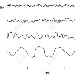 Brain Wave Frequency Chart. | Download Scientific Diagram