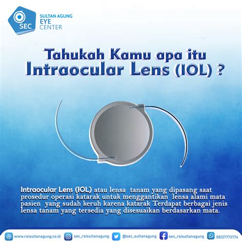 Sultan Agung Eye Center | Mengenal Intraocular Lens (IOL)