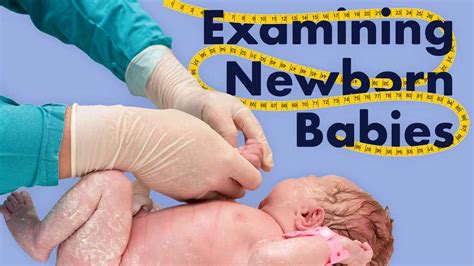 Examination of the Newborn | Ausmed