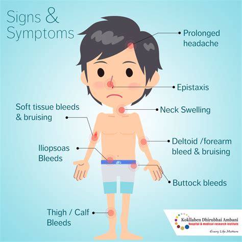 Symptoms of Hemophila - Health Tips from Kokilaben Hospital