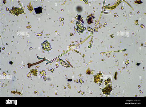 Fungal and fungi hyphae under the microscope in the soil and compost ...