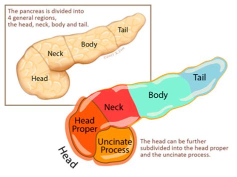 Pancreas Basics - Pancreatic Cancer | Johns Hopkins Pathology