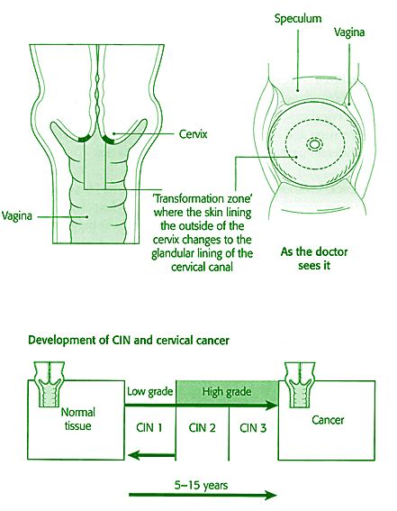 Patient Information