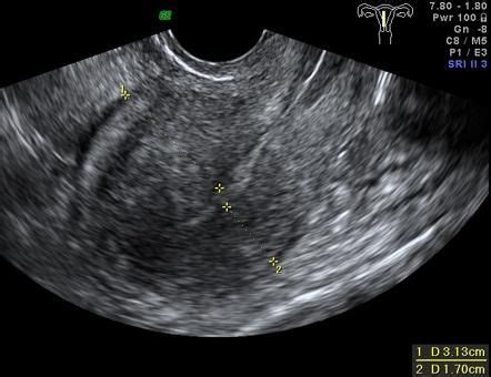 Pin on ultrasound