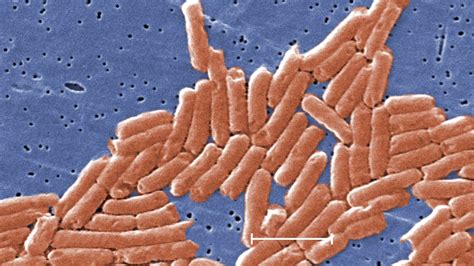 Nationwide Salmonella outbreak kills one and sickens nearly 1,000 ...