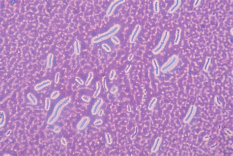 Bacterial Capsule - Definition, Functions, & Diagram