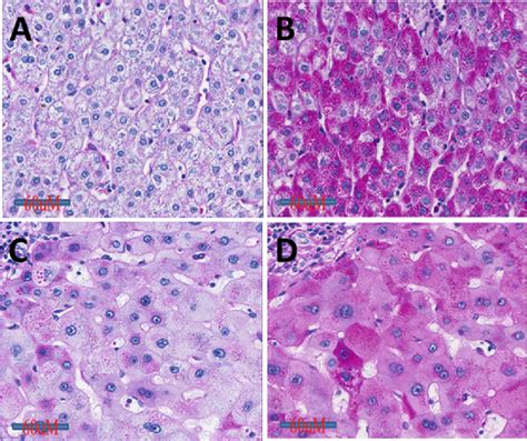 Periodic Acid-Schiff Staining with Diastase. | Semantic Scholar