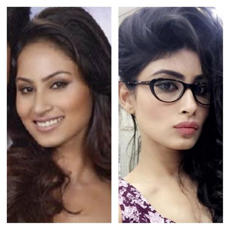 Mouni Roy Before After Plastic Surgery Makeover - Dr. Niketa Sonavane