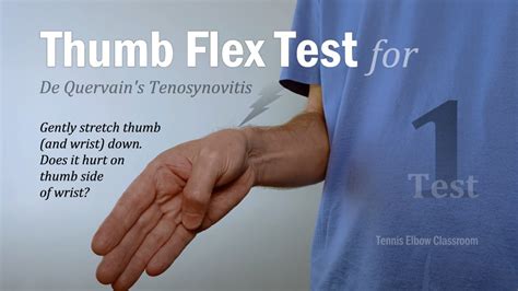 3 Quick Tests for De Quervain's / Mommy Thumb – Diagnose Yourself