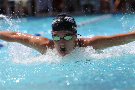 Cupping Marks On Swimmers - Cupping Birmingham