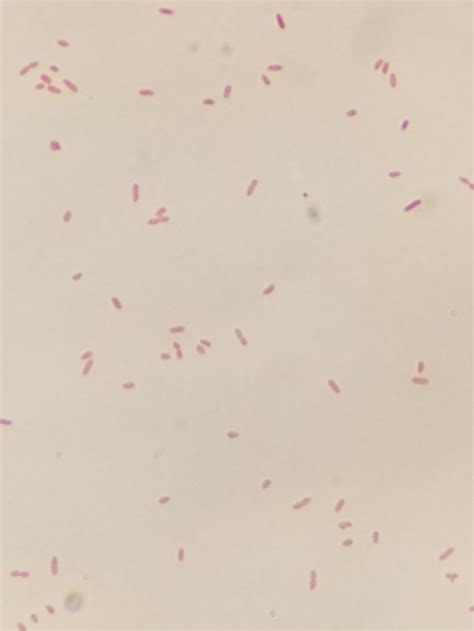 Gram stain showing Aeromonas which are a gram-negative facultative... | Download Scientific Diagram