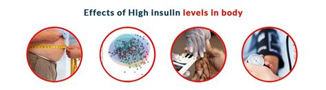 Hyperinsulinemia: Causes, Symptoms, Disease, Treatment and Effect on Our Body