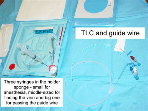 Clinical Notes: Central Line Placement: A Step-by-Step Procedure Guide ...