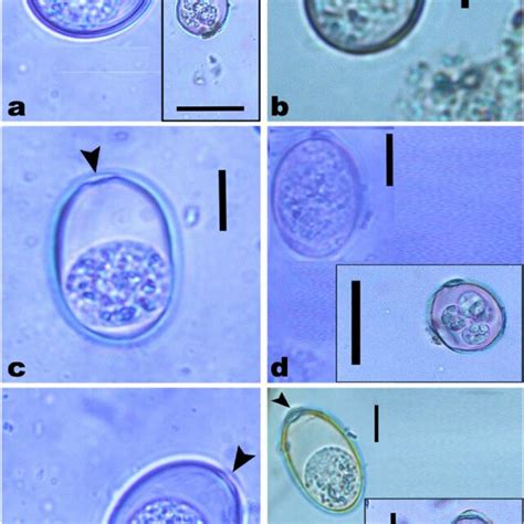 The recovered Eimeria species in feces of the examined sheep | Download ...