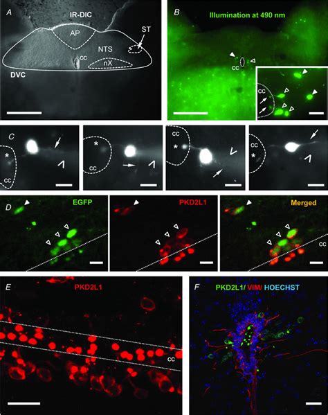 In the dorsal vagal complex S-CSF-cNs are present and express PKD2L1... | Download Scientific ...