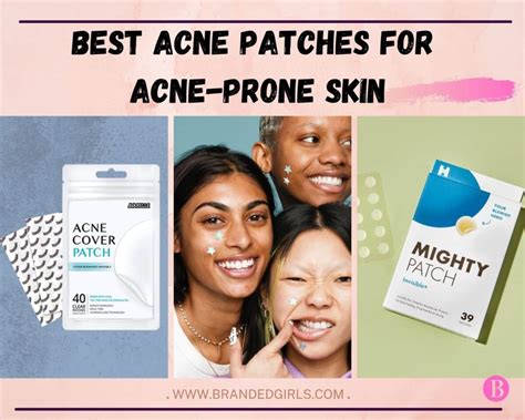 10 Best Acne Patch Brands For Acne Prone Skin With Reviews