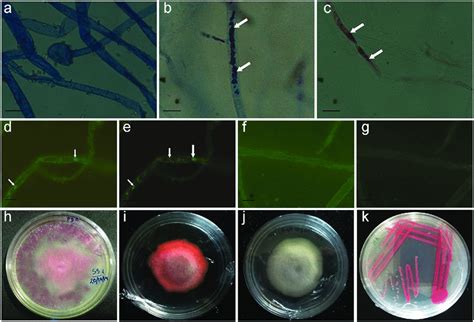 Observation of fungal hyphae of hyphae of fungal sample SS7 under light ...