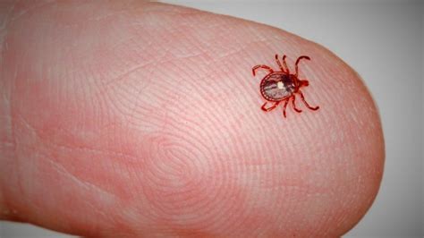 Tick bite leaves St. Louis County woman allergic to red meat | FOX 2