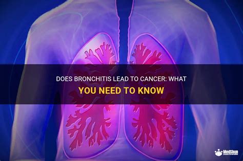 Does Bronchitis Lead To Cancer: What You Need To Know | MedShun