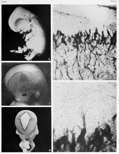 Paper - The development of the subcutaneous vascular plexus in the head ...