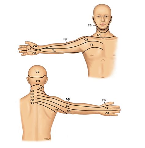 Cervical dermatomes PI - UpToDate