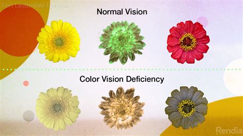 Color Blindness - Causes and Diagnosis | Fort Lauderdale Eye Institute