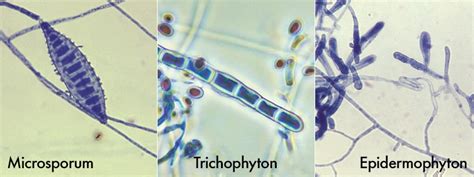 Dermatophyte Identification Chart