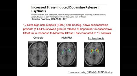 Sir Robin Murray - The Environmental Causes of Schizophrenia ...