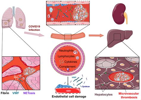 Vascular Endothelial Damage in the Pathogenesis of Organ Injury in ...