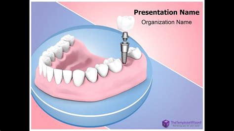 Dental Implant PowerPoint Presentation Template - TheTemplateWizard - YouTube