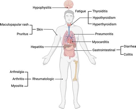 Frontiers | Checkpoint inhibitor immune-related adverse events: A focused review on ...