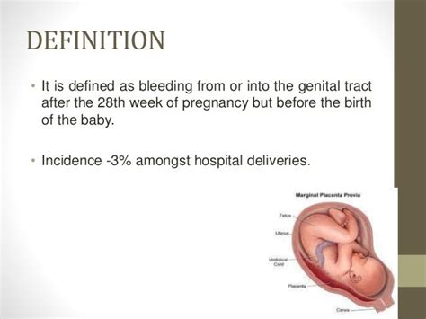 Antepartum haemorrhage i