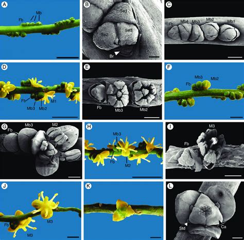 SEM and macroscopic views of the developing acervulus in Gaussia... | Download Scientific Diagram