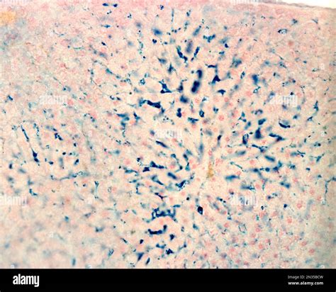 Kupffer cells are macrophages of the liver. Colloidal iron acts as a vital stain that can be ...