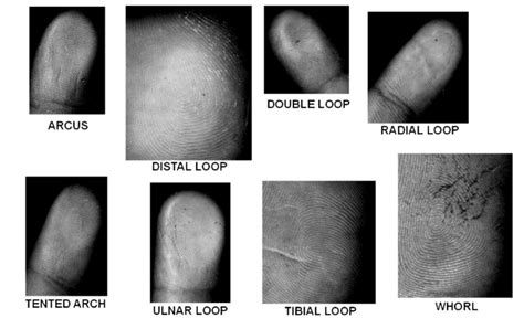 Dermatoglyphic patterns obtained by computer scanner method. | Download ...