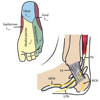 Chiropractic Treatment of Tarsal Tunnel Syndrome — ChiroUp