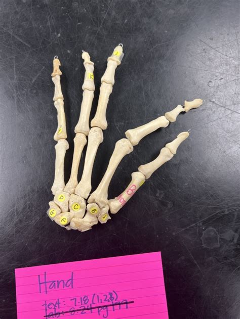 hand bones Diagram | Quizlet