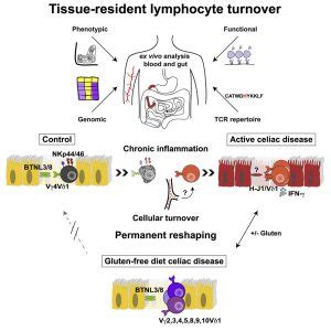 Chronic Inflammation Permanently Alters Immune Cells in Celiac Patients | Celiac Disease Foundation