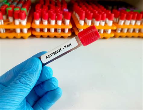 Meaning of Aspartate Aminotransferase (AST/SGOT) | Bowtie