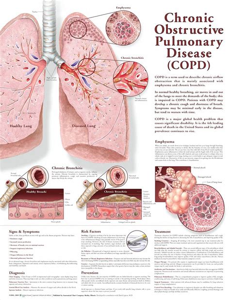 Health Blog | Pulmonary disease, Chronic obstructive pulmonary disease ...