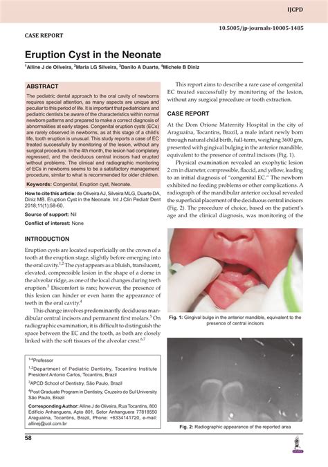 (PDF) Eruption Cyst in the Neonate