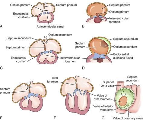 Embryology and Physiology of the Fetal Heart | Radiology Key