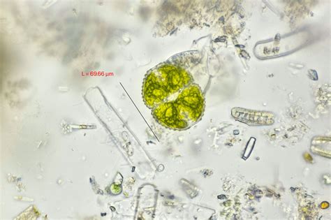 Cosmarium botrytis | The Microscopic Life of Shetland Lochs