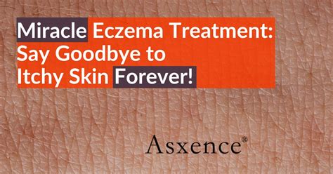 Miracle Eczema Treatment: Say Goodbye to Itchy Skin Forever!